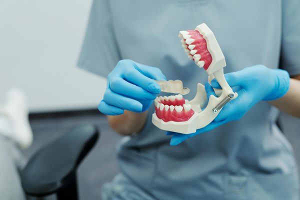 Découvrez les techniques innovantes d'orthodontie au cabinet du dr soheili